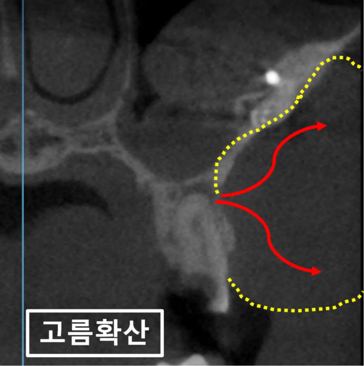 바른본치과