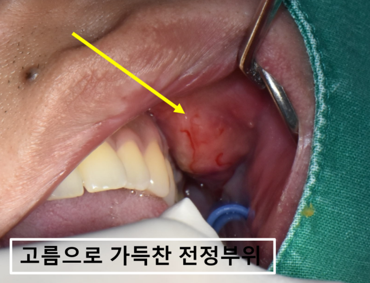 바른본치과