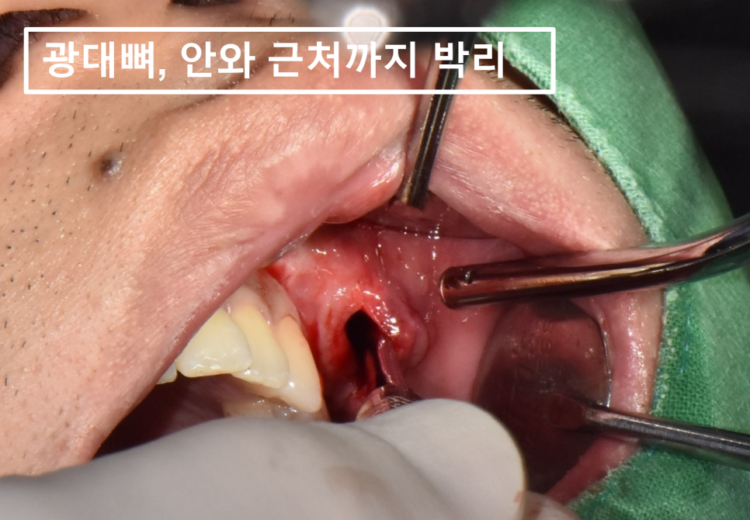 바른본치과