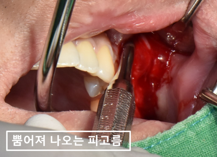 바른본치과