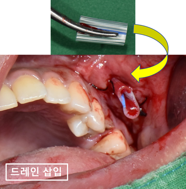 바른본치과