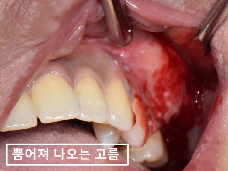 바른본치과