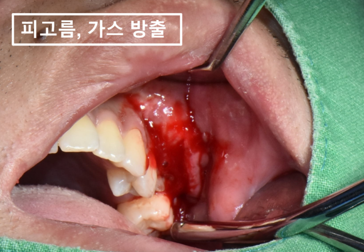 바른본치과