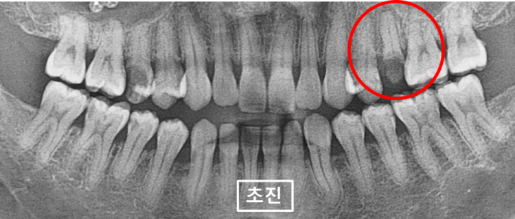 바른본치과