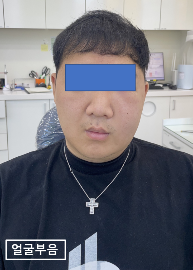 바른본치과