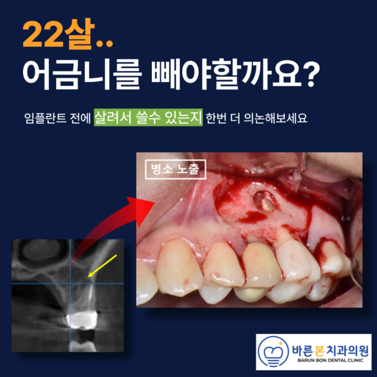 수원치과추천