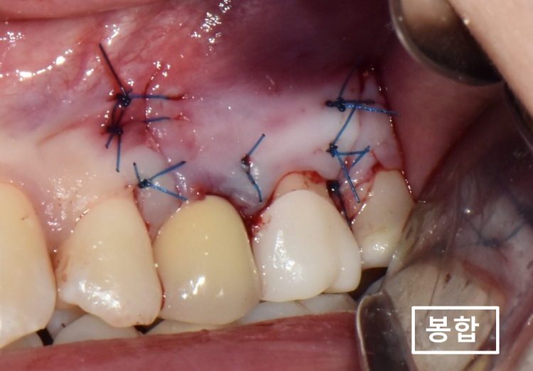 매탄동치과
