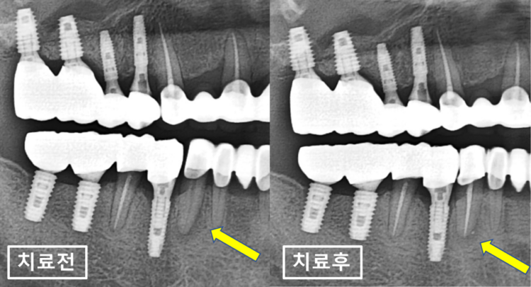 매탄동치과