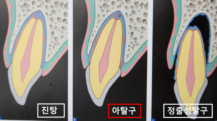 매탄동치과