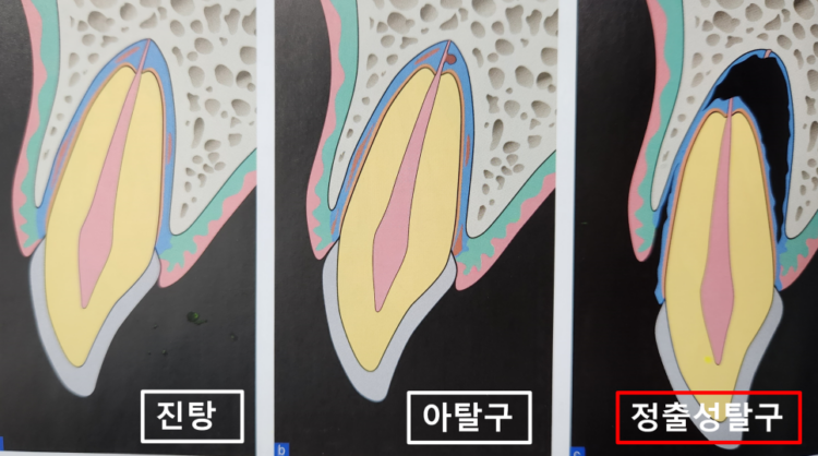 매탄동치과