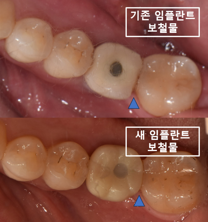 매탄동치과