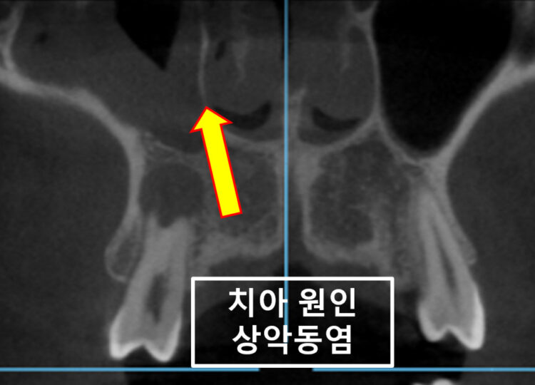 수원치과잘하는곳