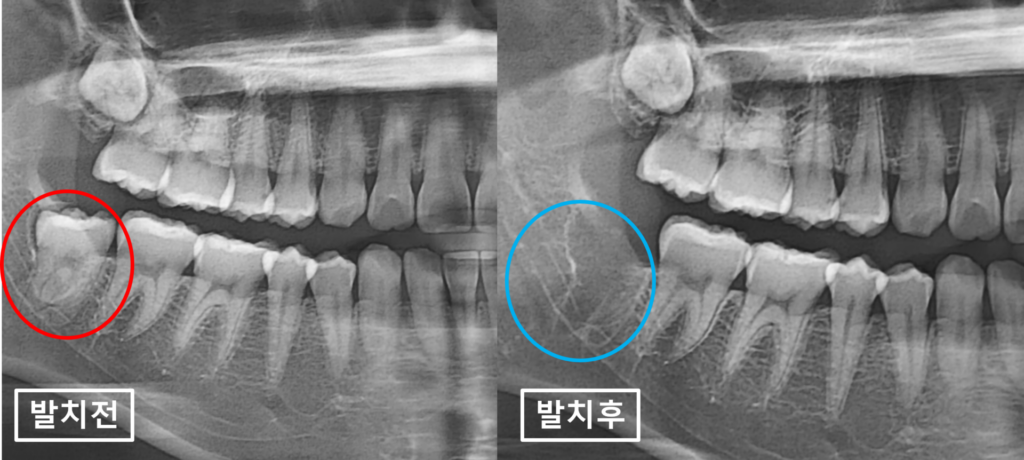 수원시청역치과