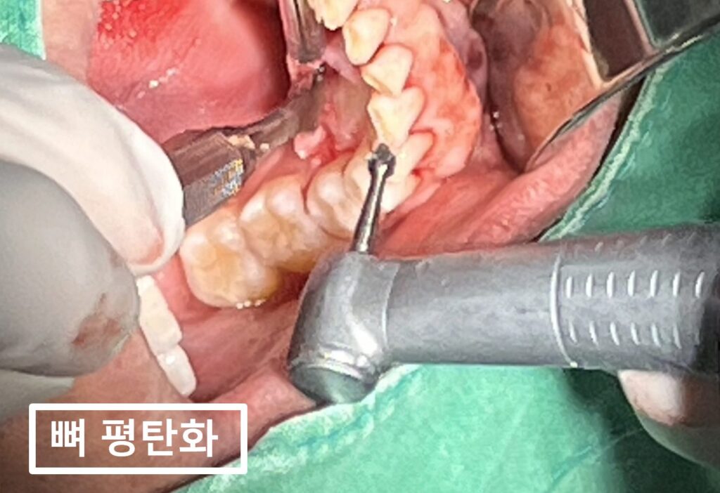 수원시청역치과