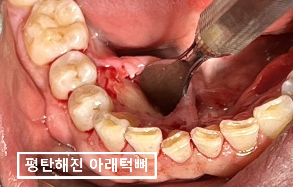 수원시청역치과