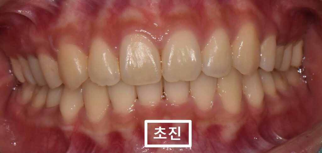 매탄동치과