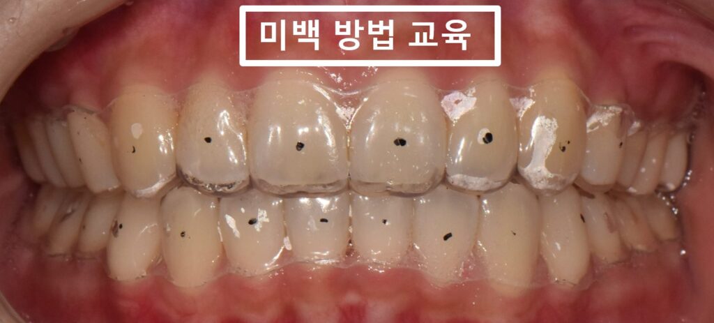 매탄동치과