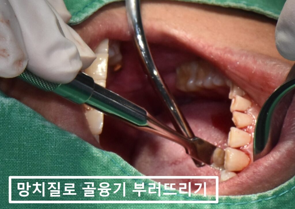 수원시청역치과