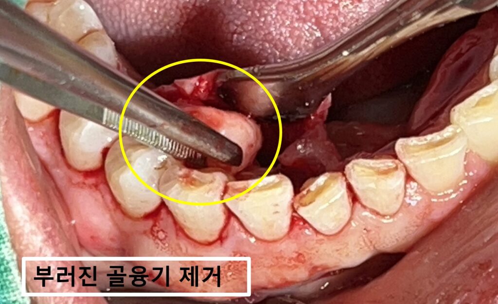 수원시청역치과